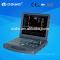 DW-C60 maquina ecografia &amp; Laptop Ultraschall Farbdoppler